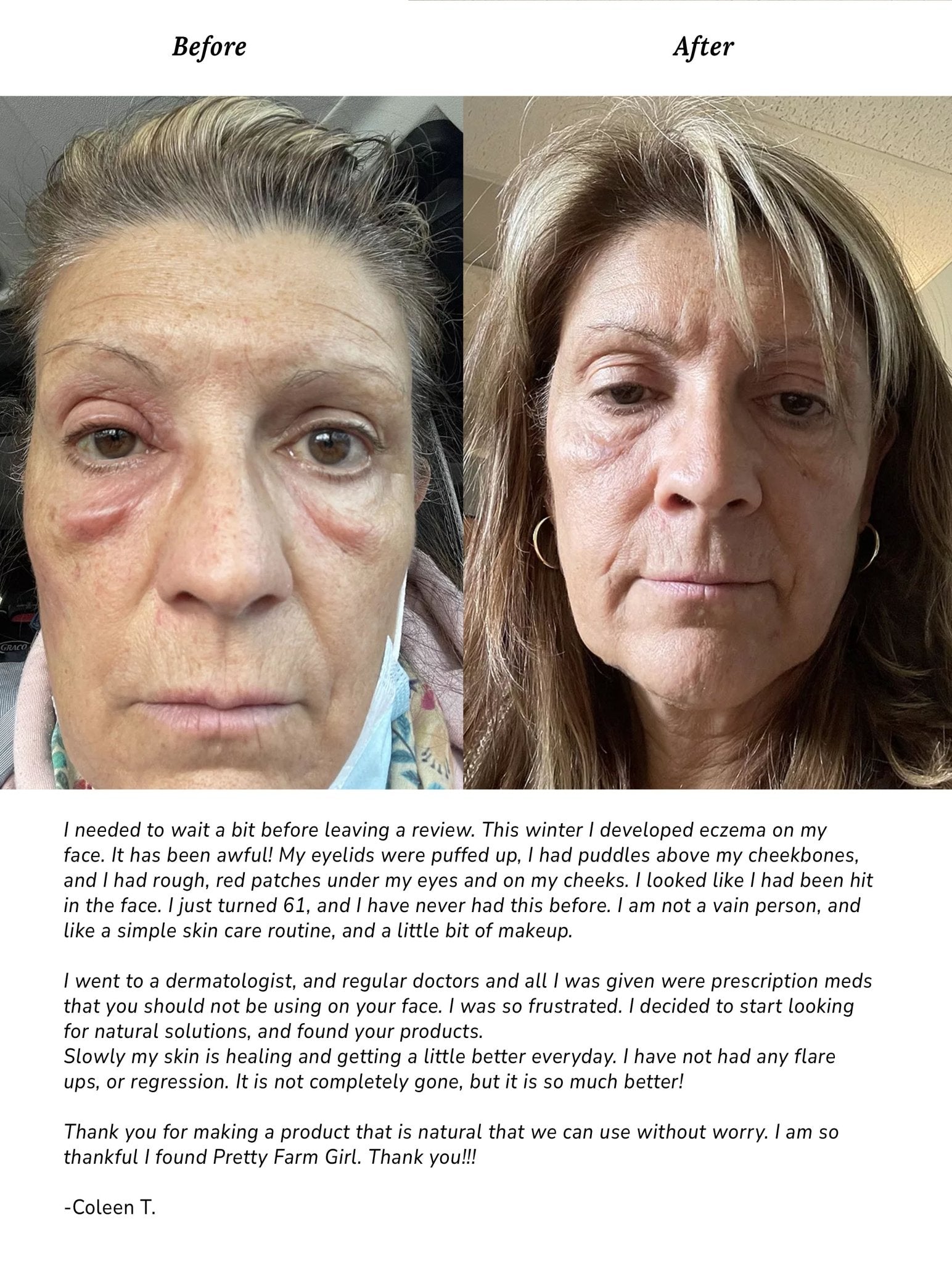 Million Dollar Bill presents: Pure + Simple Skin Kit for Sensitive Skin - The Million Dollar Bill Co.